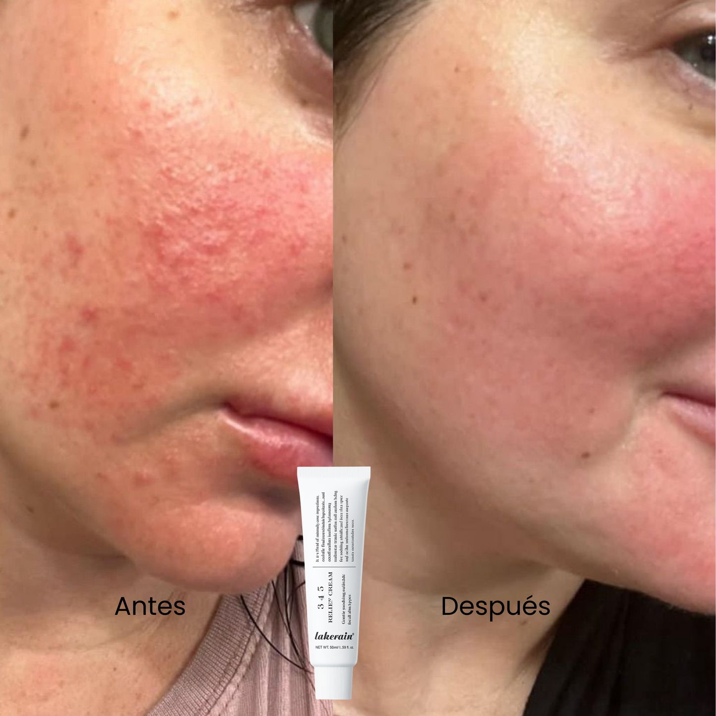 Crema Reparadora Total 345